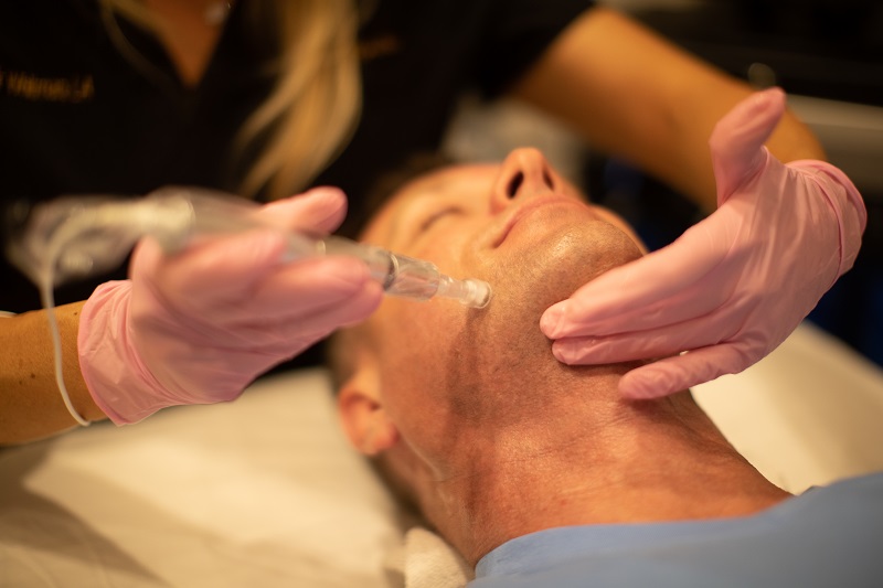 how to rejuvenate skin with microneedling