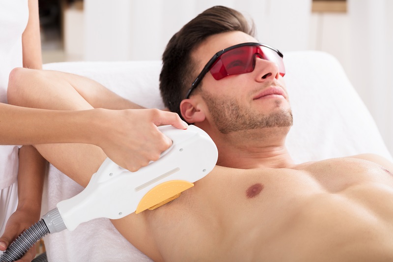 Laser Hair Removal for Men