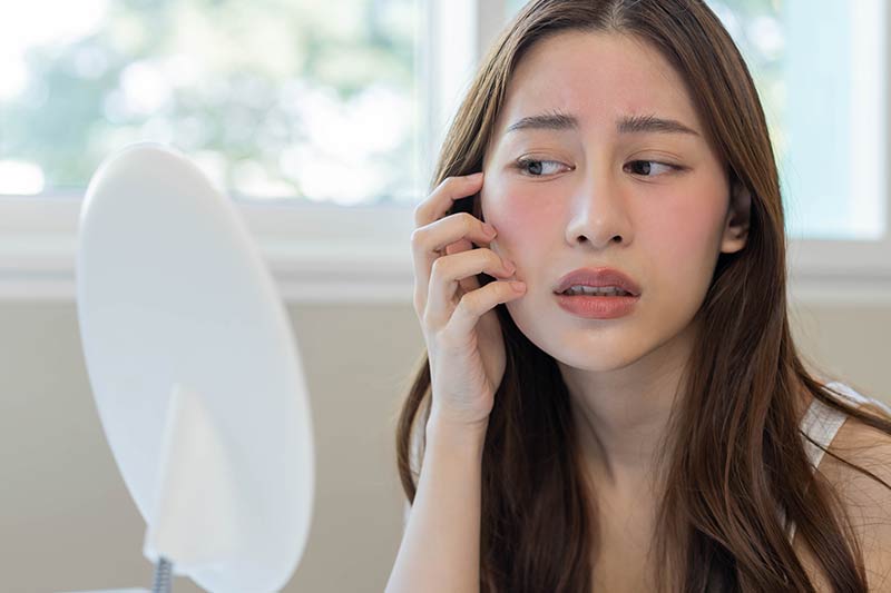 Holistic treatments for eczema