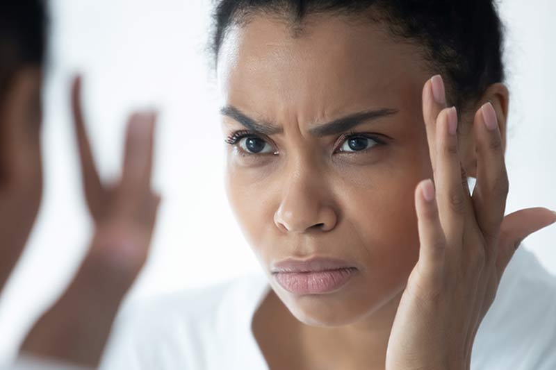 Botox for frown lines