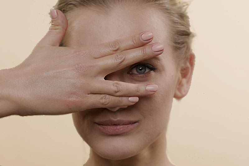 Nose filler gone wrong