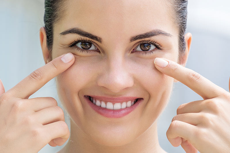 Undereye filler injection area.