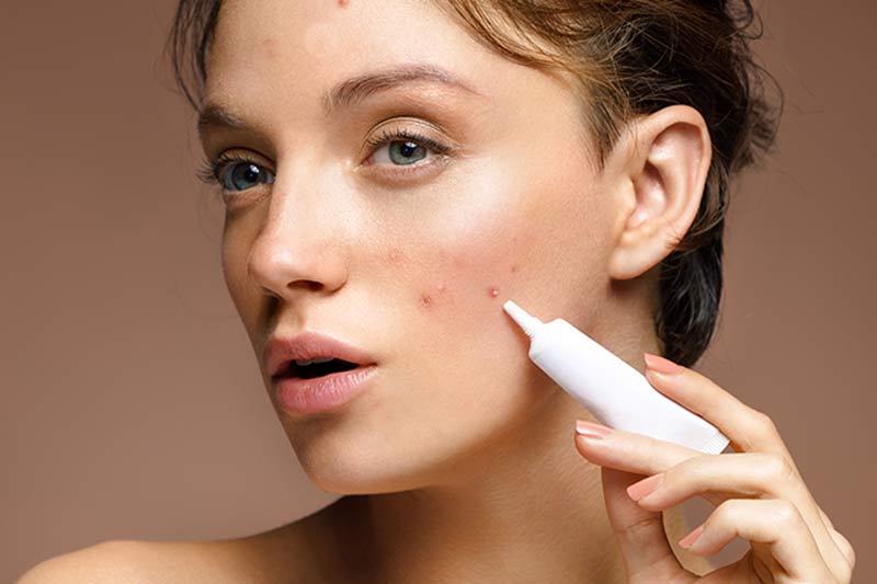 Is hyaluronic acid good for acne?